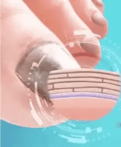 Spray Anti Hongos – FungiBee 🐝