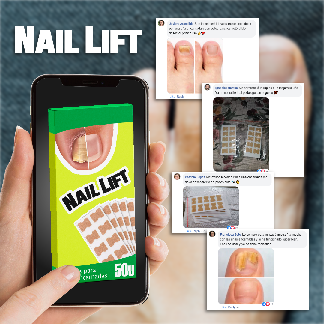 2X1 / NailLift™ - Parches para Uñas Encarnadas