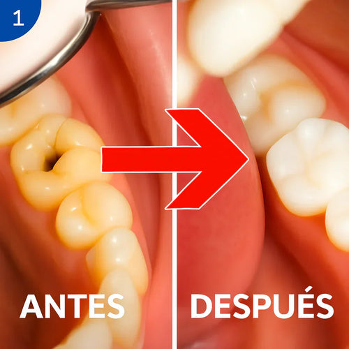 LapizDental® Nudenta Reparación Odontológica – Escudo Dental Avanzado