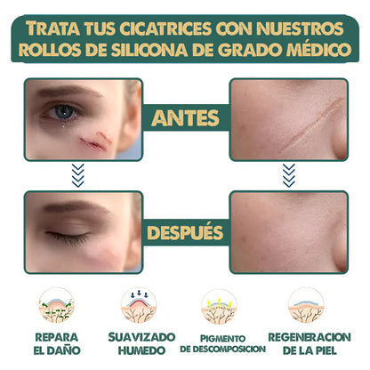 Cinta Cicatrizante , Dile adiós a las cicatrices en semanas!